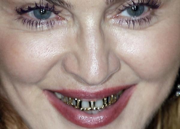 женщина с золотыми зубами
