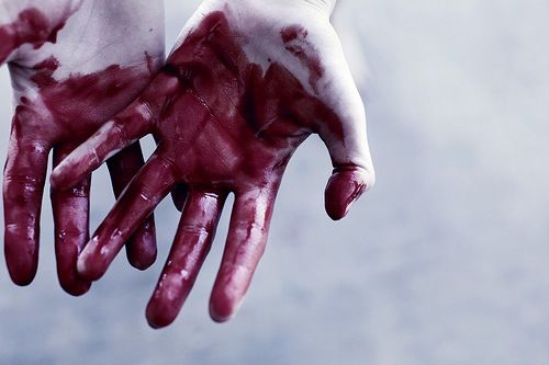 Руки в крови