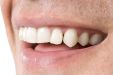 К чему снится выпадение зубов: сонник выпадающие зубы